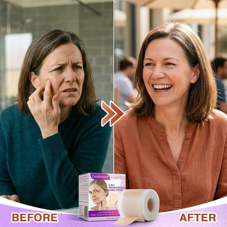 CareBreeze® 3-in-1 Microneedle Anti-Aging Patch - Image 12